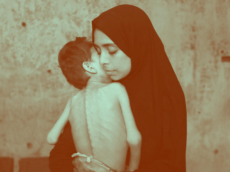 gaza hunger