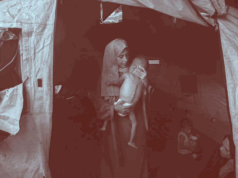 تشريح الموت جوعاً في غزّة